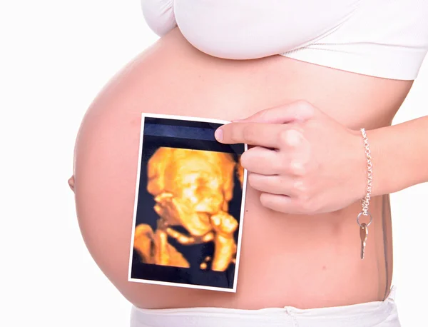 Pregnant 3d ultrasound on his belly — Stock Photo, Image