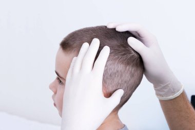 A dermatologist with gloves examines a childs head. Lice concept