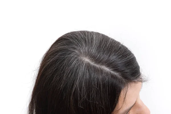 Uma Jovem Com Cabelo Grisalho Conceito Cabelo Cinza Precoce — Fotografia de Stock