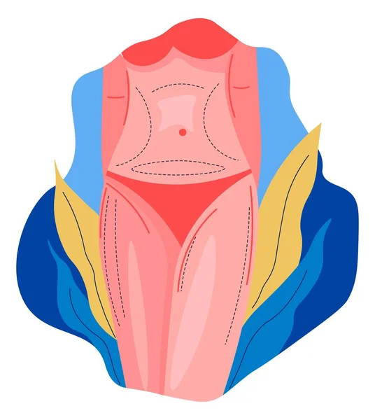 Correctie van de lichaamsvorm, hefprocedure vector — Stockvector