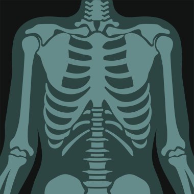 Göğüs röntgeni, solunum hastalıkları olan hastanın röntgen taraması. Hastane ve klinikler hastalıkların tedavisi, teşhisi ve sonuçların analizi. Düz biçim illüstrasyonunda vektör