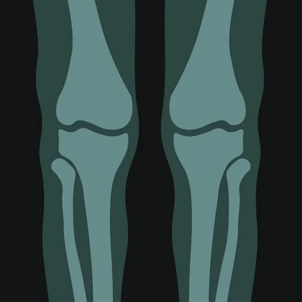 Scan Human Knees Bones Joints Examination Diagnosis Help Ray Healthcare — Stock Vector