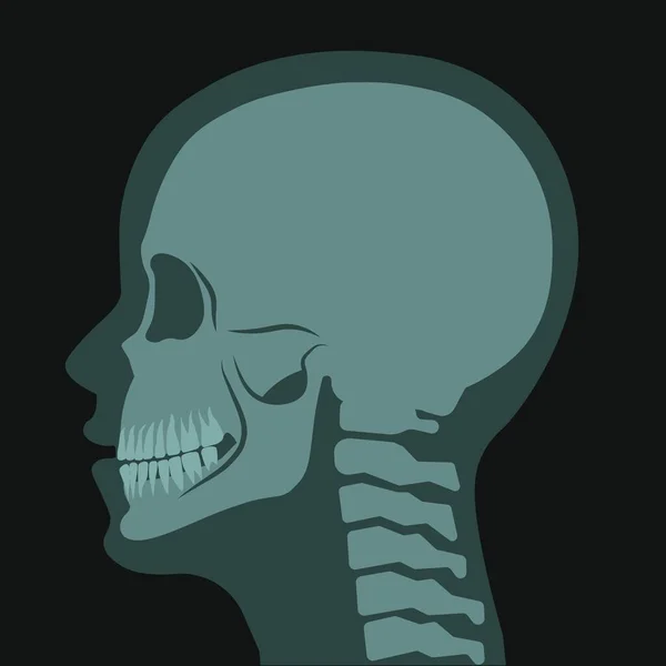 Roentgen Tomography Ray Skull Human Body Anatomy Diagnosis Healthcare Prevention — Stock Vector