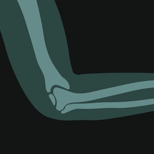 Patient Arm Problem Ray Scan Elbow Joint Anatomical Structure Care — 스톡 벡터