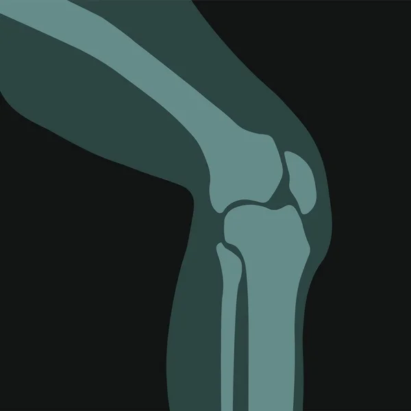 Roentgen Scan Knee Joint Ray Detailed Bone Leg Healthcare Clinics — Vector de stock