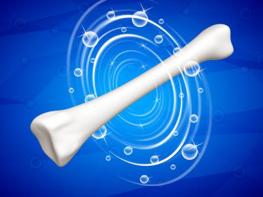 Mavi arka planda bir insan kemiğinin iyileşmesi. 3B illüstrasyon.