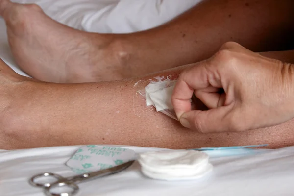 Removing a plaster off a leg — Stock Photo, Image