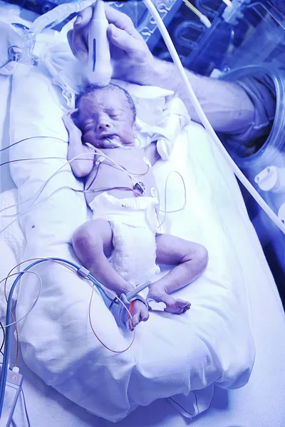 Infant irradiated with ultraviolet light — Stock Photo, Image