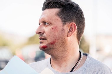 Kaykayıyla düştükten sonra yüzü yaralanan bir kaykaycı..