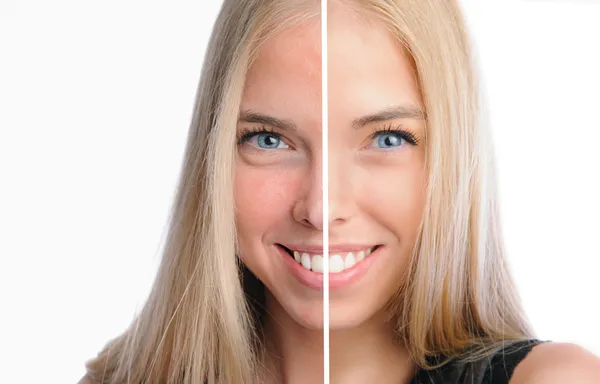 Rosto de mulher bonita antes e depois do retoque — Fotografia de Stock