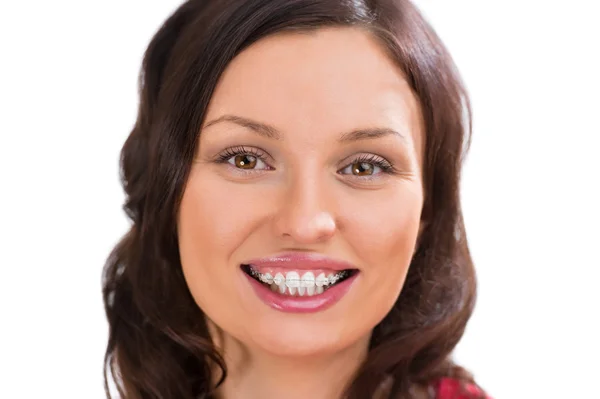 Vrouw dragen orthodontische keramische haken — Stockfoto