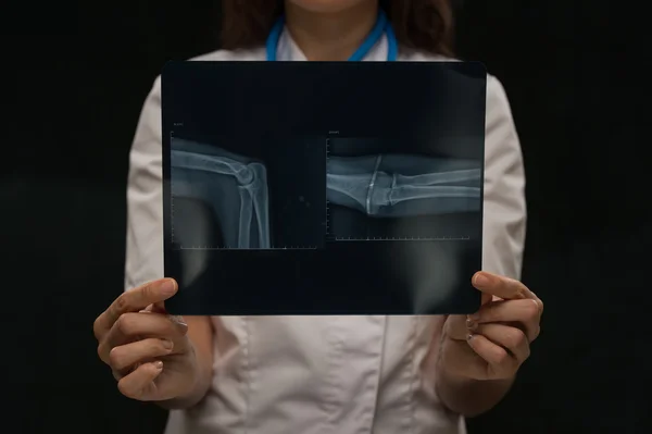 Médico examinando radiografia de ossos do braço — Fotografia de Stock
