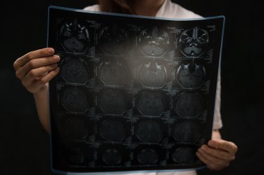 Doktor Mr röntgen görüntüleme
