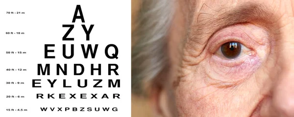 Detail Portrait Elderly Women Close Test Vision Chart — стоковое фото