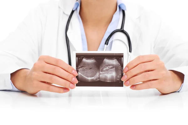 Midsection of woman holding ultrasound — Stock Photo, Image