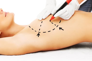 Doctor marking breast for surgery clipart