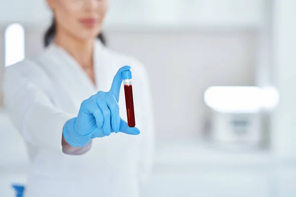 Woman holding test tube with blood and mixing machine — Stockfoto
