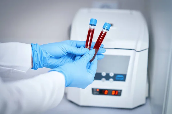 Test tube with blood and mixing machine — Stockfoto