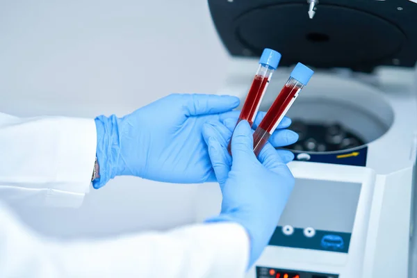 Test tube with blood and mixing machine — Foto Stock