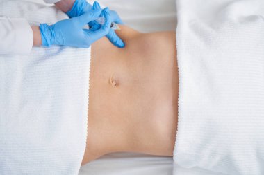 Kadın vücudunun farklı yerlerinde lipolizis tedavisi.