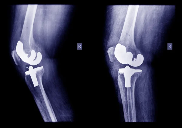 X-ray film — Stock Photo, Image