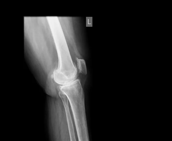 X-ray film — Stock Photo, Image