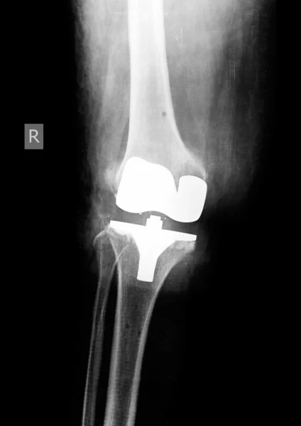 X-ray film — Stock Photo, Image