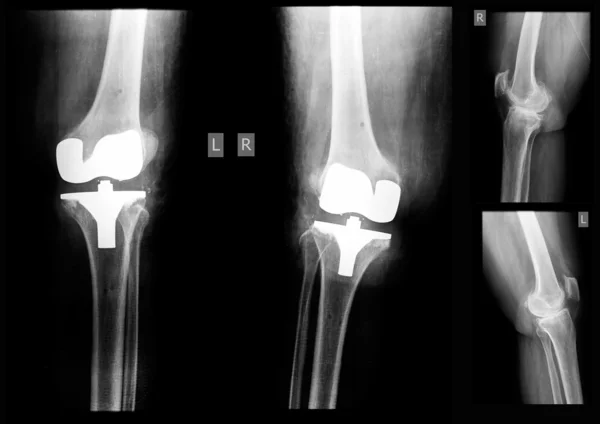 X-ray film Stock Fotografie