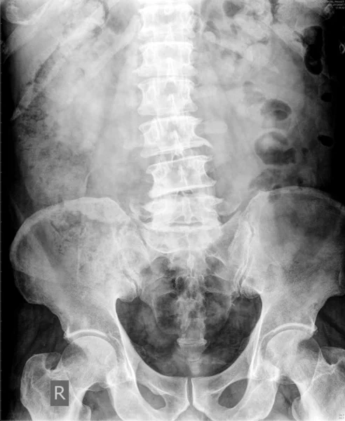 X-ray of the abdomen — Stock Photo, Image