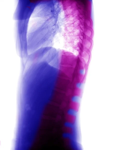 Imagen de rayos X de vértebras lumbares —  Fotos de Stock