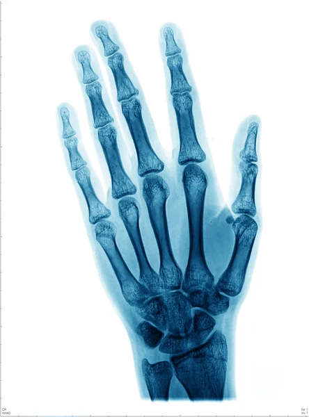 el x-ışını fotoğrafı