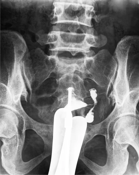 X ray macicy — Zdjęcie stockowe