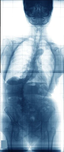 エックス線 — ストック写真