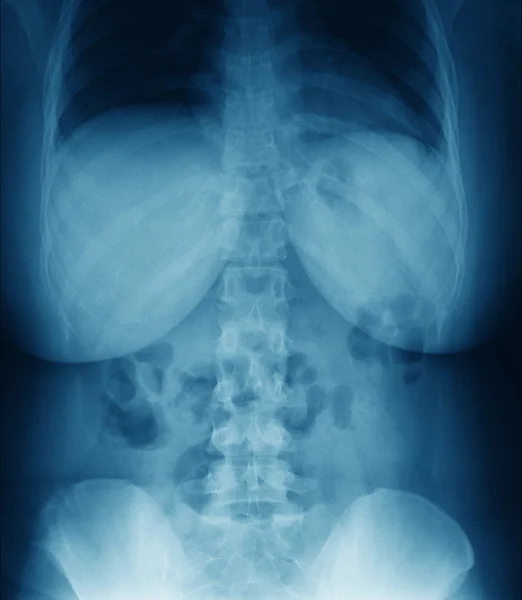 X-ray — стоковое фото