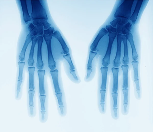 X-ray — Stock Photo, Image