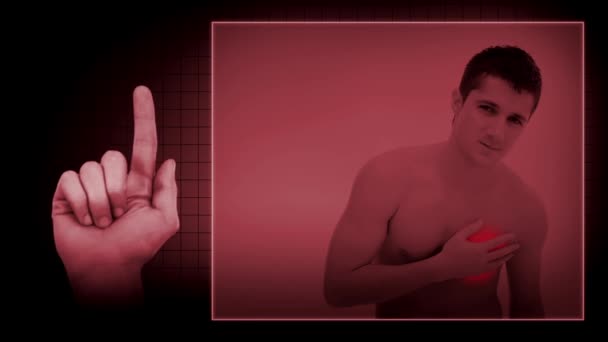 Kalp krizi-EKG'sini işareti ile — Stok video