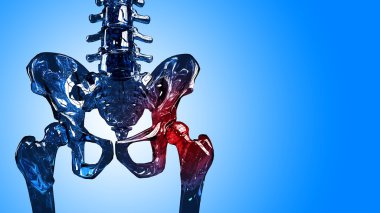 iskelet hip-pain bölümü