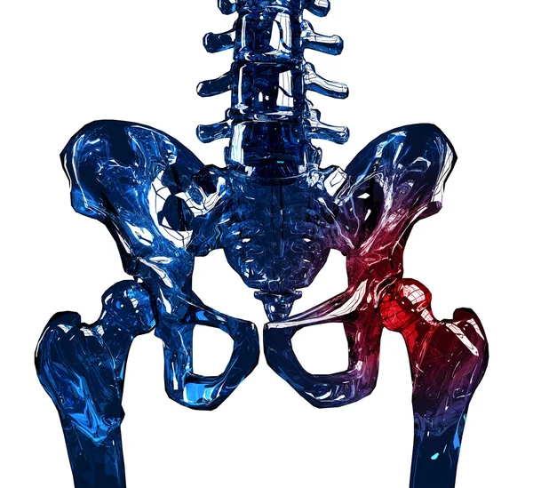 Squelette 3D concept de douleur de hanche — Photo