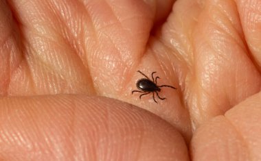 Bulaşıcı Ensefalit Ixodes Scapularis veya Persulcatus Geyik Tik Böceği Derisi. Ensefalit Virüsü veya Lyme Borreliosis Hastalığı Enfekte Ixodes Araknid Parazit Isırığı Macro.