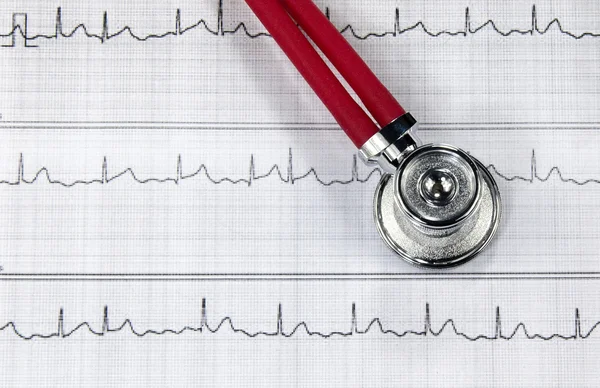 Stetoskop och EKG — Stockfoto