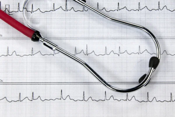Stetoskop och EKG — Stockfoto