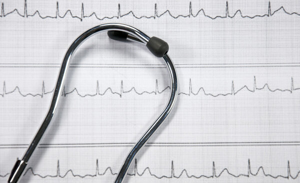 стетоскоп и ЭКГ
