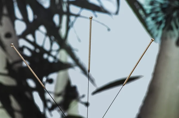 Acupuncture needle — Stock Photo, Image