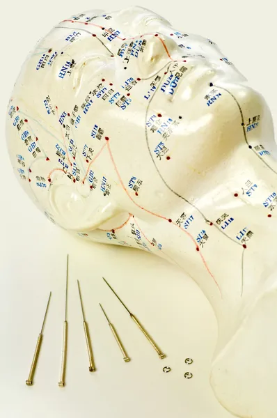Akupunktur nålar med huvudet modell — Stockfoto