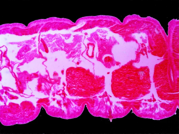 Visão microscópica de uma minhoca — Fotografia de Stock