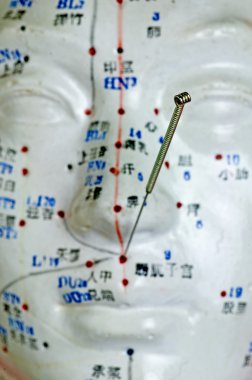 Akupunktur iğnesi baş modeli