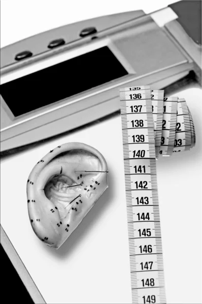 Acupunctuur voor weight loss — Stok fotoğraf