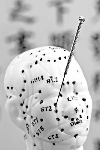 Acupunctuur naalden op hoofd model — Stockfoto