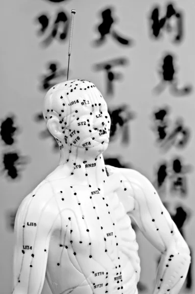 Igly do akupunktury na modelu — Zdjęcie stockowe