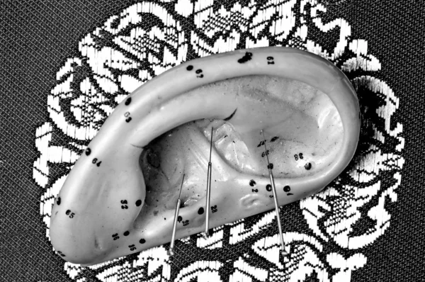 Акупунктурні голки та модель вуха — стокове фото